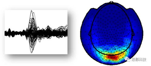 思影數(shù)據(jù)處理服務六 腦磁圖（MEG）數(shù)據(jù)處理與軟件開發(fā)